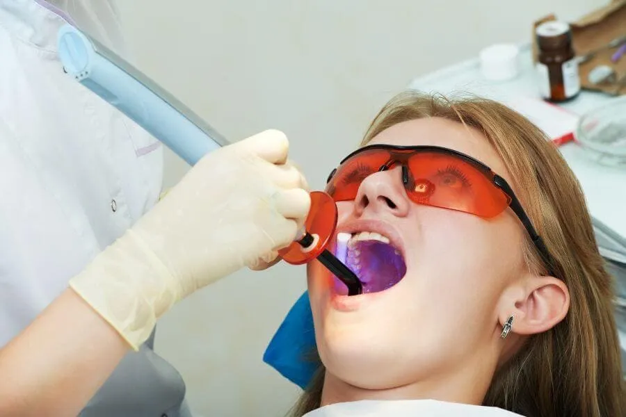 Sealants in Weston - Dentist in Plantation General Dentistry Artisa Dental 754-755-6350