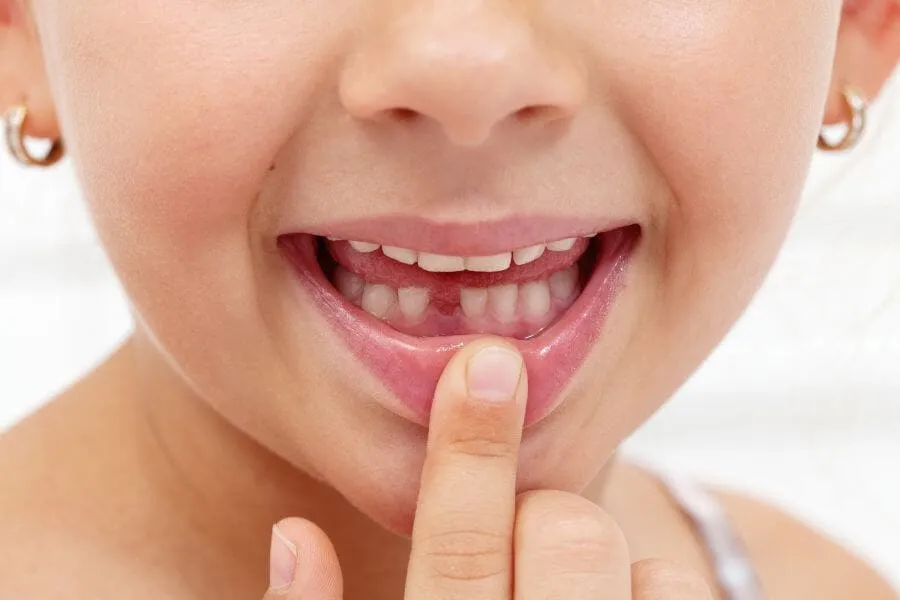 Dentist in Plantation General Dentistry services Artisa Dental 754-755-6350