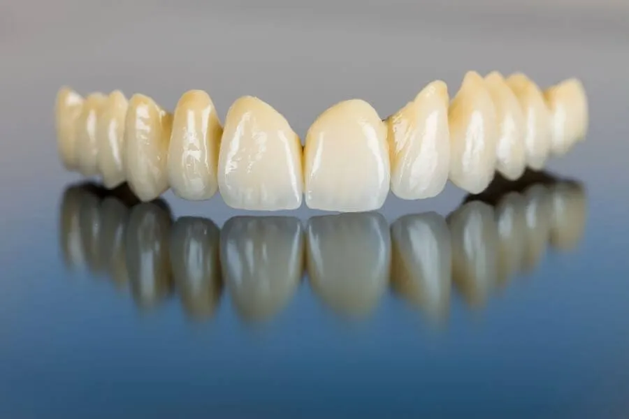 Dentist in Weston General Dentistry services Artisa Dental 954-928-9192 Porcelain teeth - dental bridge